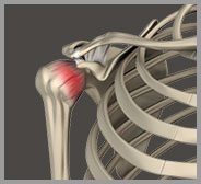 Frozen Shoulder/Shoulder Stiffness
