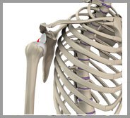 Shoulder Instability Image Shoulder Instability