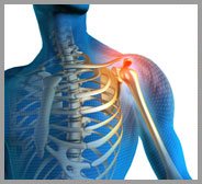 Shoulder Pain Image Shoulder Pain