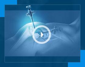Patient Educational Videos